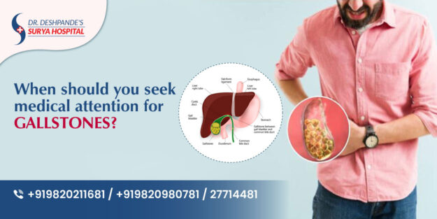 GallStone Specialist In Nerul
