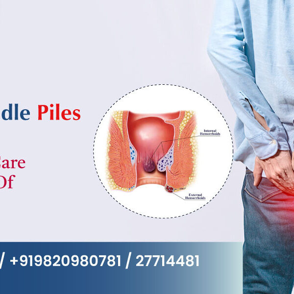 Piles Surgery In Navi Mumbai