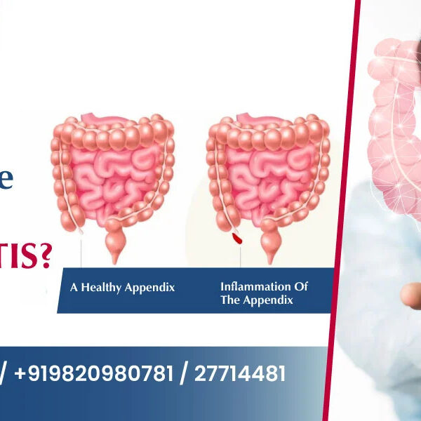 Appendix Removal Surgery In Navi Mumbai