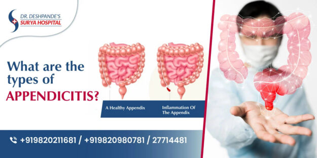 Appendix Removal Surgery In Navi Mumbai