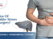 Gall Bladder Surgery in Nerul