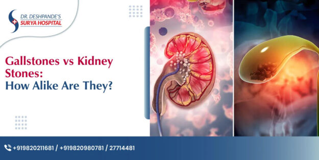 Gallstones removal Doctor In Navi Mumbai