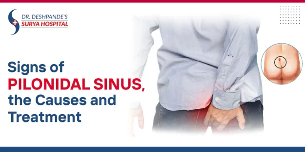 Signs of Pilonidal Sinus, the Causes and Treatment