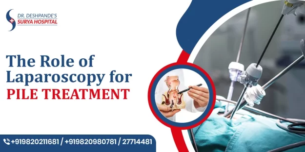 The Role of Laparoscopy for Pile Treatment