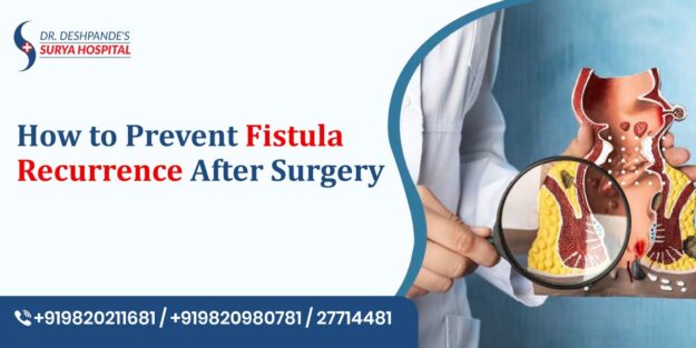 How to Prevent Fistula Recurrence After Surgery