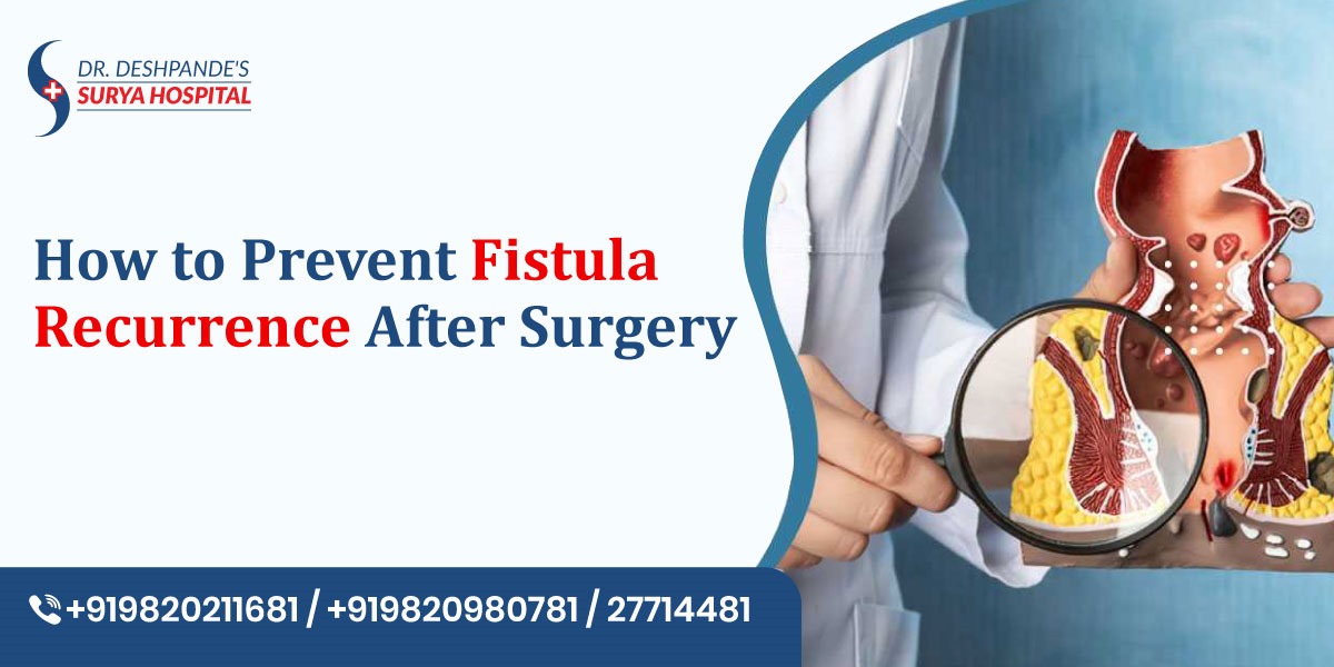 How to Prevent Fistula Recurrence After Surgery