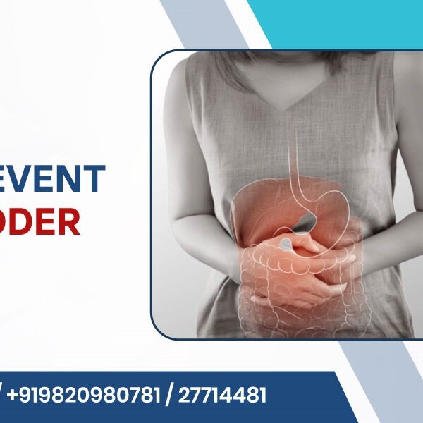 Ways to Prevent Gallbladder Stones