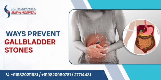 Ways to Prevent Gallbladder Stones