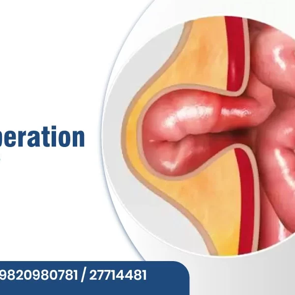 Is Hernia Operation Dangerous?