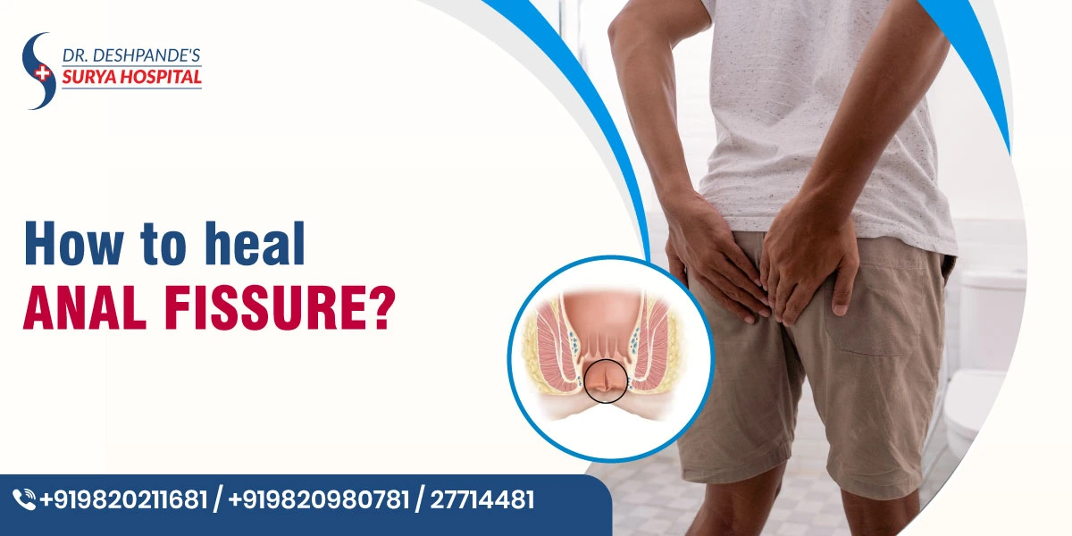 How to Heal Anal Fissure