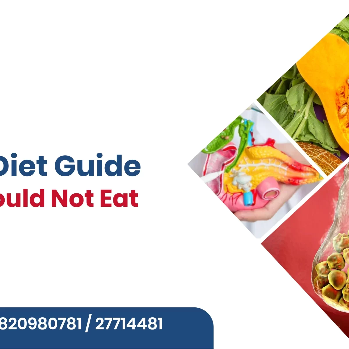 Gallstones Diet Guide: Foods You Should Not Eat