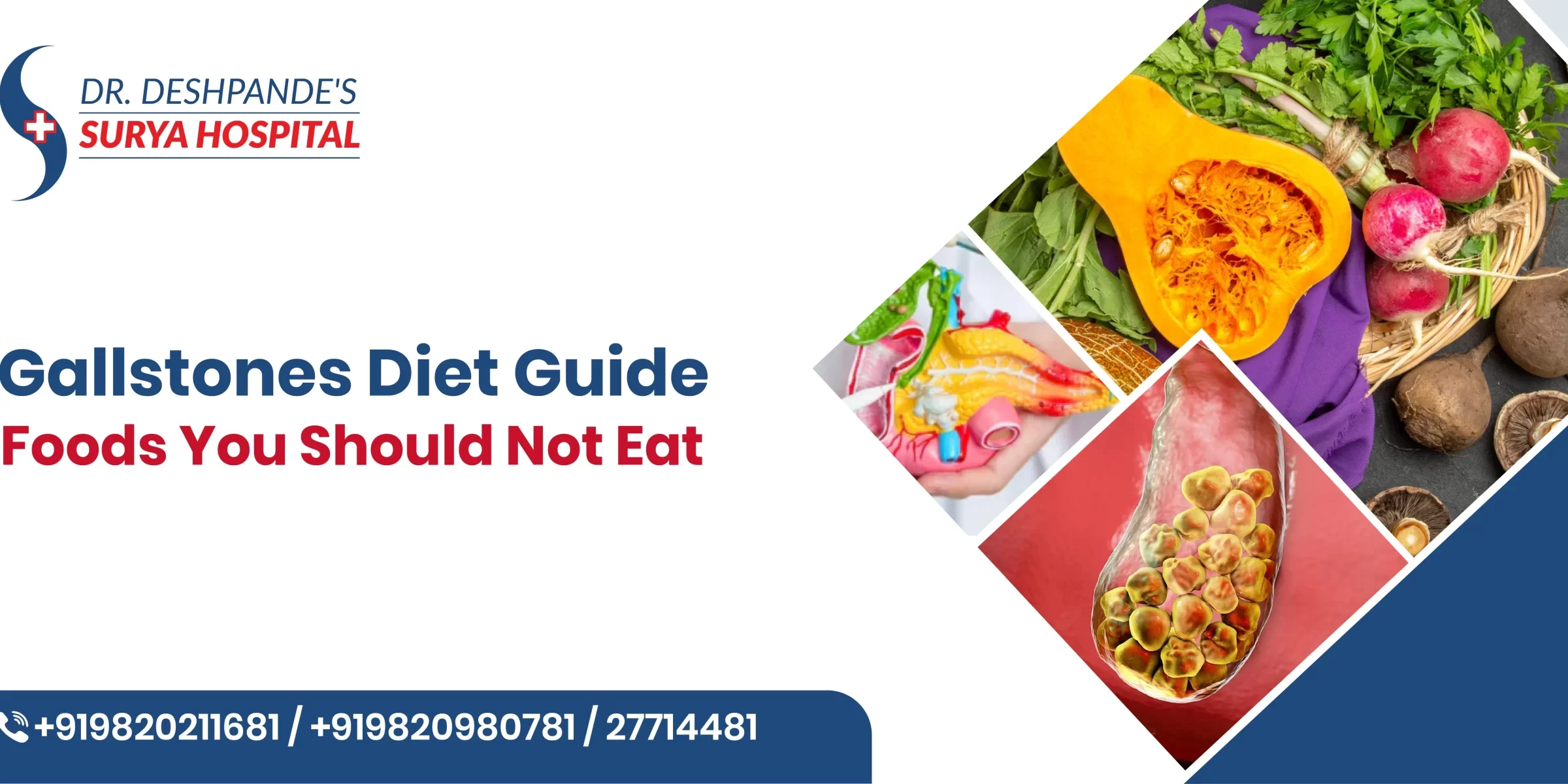 Gallstones Diet Guide: Foods You Should Not Eat