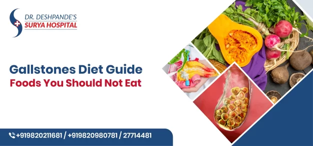 Gallstones Diet Guide: Foods You Should Not Eat