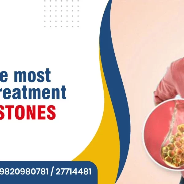 What is the Most Common Treatment for Gallstones?