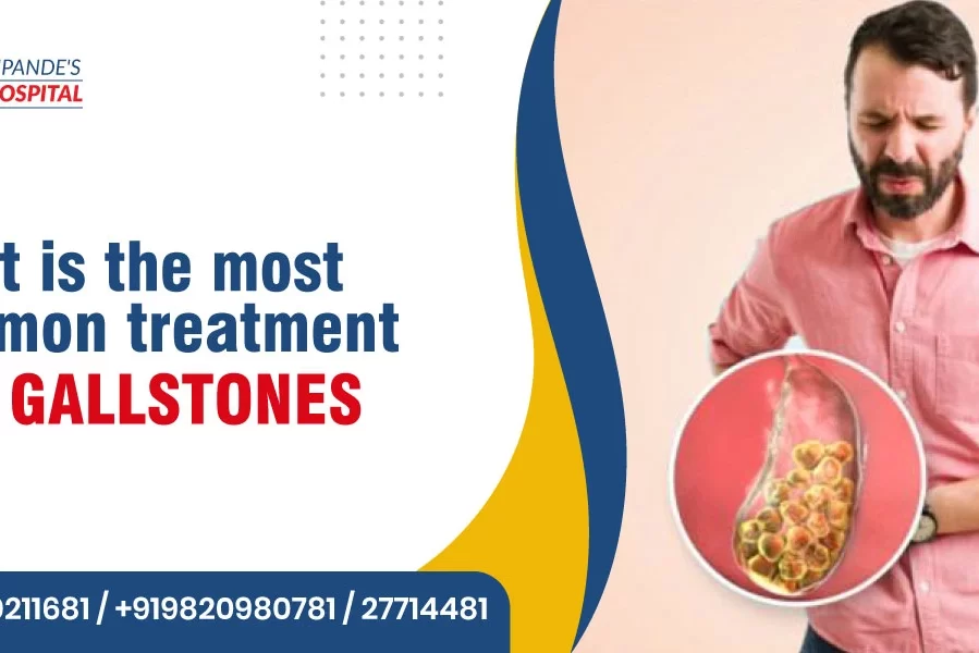What is the Most Common Treatment for Gallstones?
