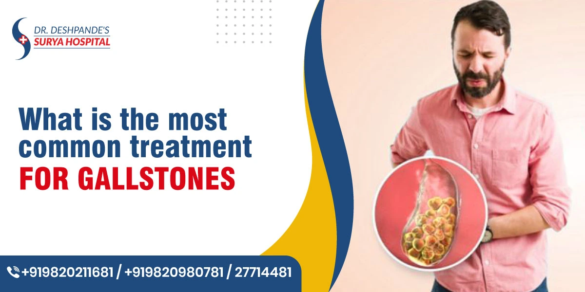 What is the Most Common Treatment for Gallstones?