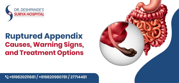 Ruptured Appendix: Causes, Warning Signs, and Treatment Options