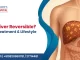 Is Fatty Liver Reversible? Causes, Treatment & Lifestyle Changes