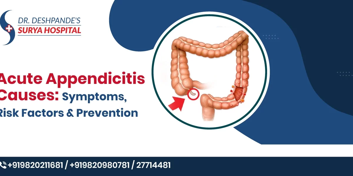 Acute Appendicitis Causes: Symptoms, Risk Factors, and Treatment