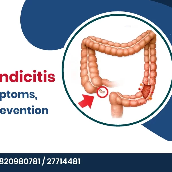 Acute Appendicitis Causes: Symptoms, Risk Factors, and Treatment