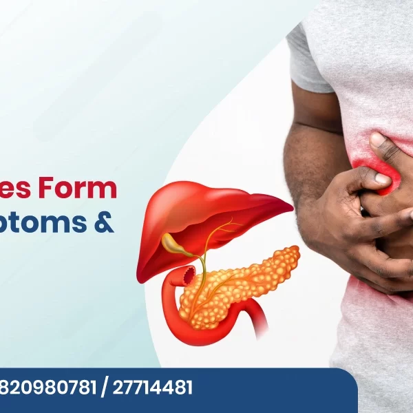 Why Gallstones Form: Causes, Symptoms & Prevention