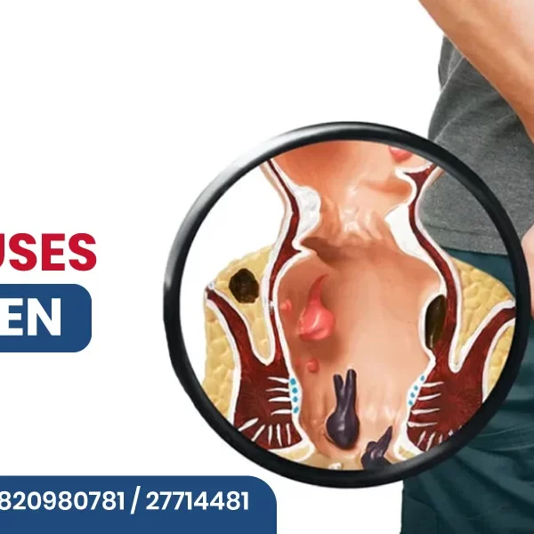 What Causes Piles in Men