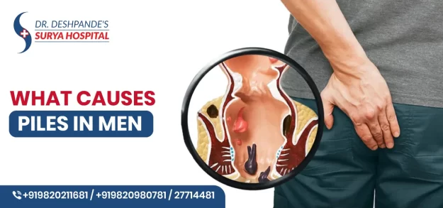 What Causes Piles in Men