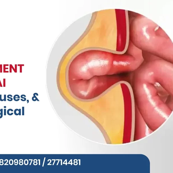 Hernia Treatment in Navi Mumbai