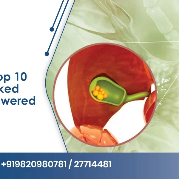 Gallstones