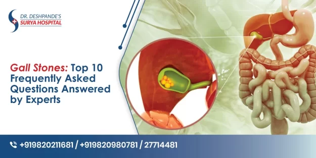 Gallstones