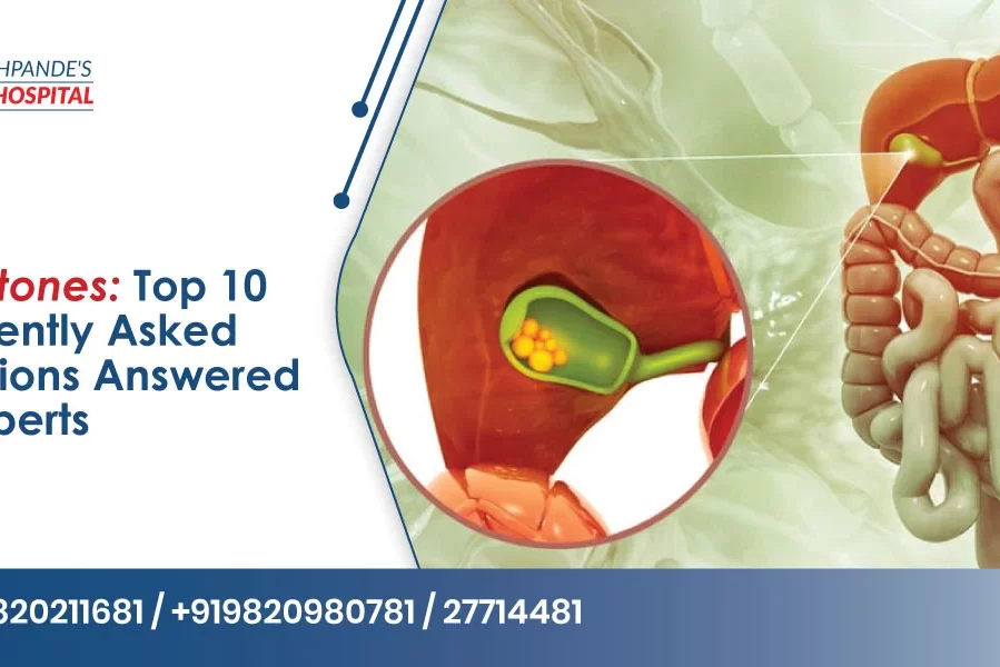 Gallstones