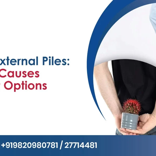 Internal vs External Piles: Common Symptoms and Causes