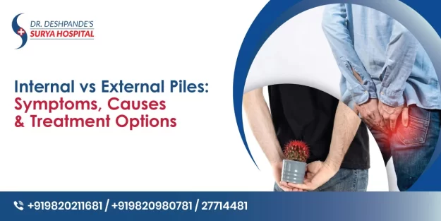 Internal vs External Piles: Common Symptoms and Causes