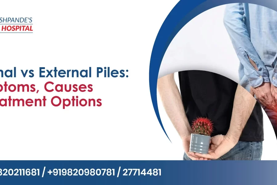 Internal vs External Piles: Common Symptoms and Causes