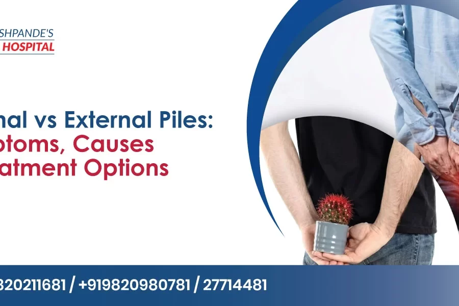 Internal vs External Piles: Common Symptoms and Causes
