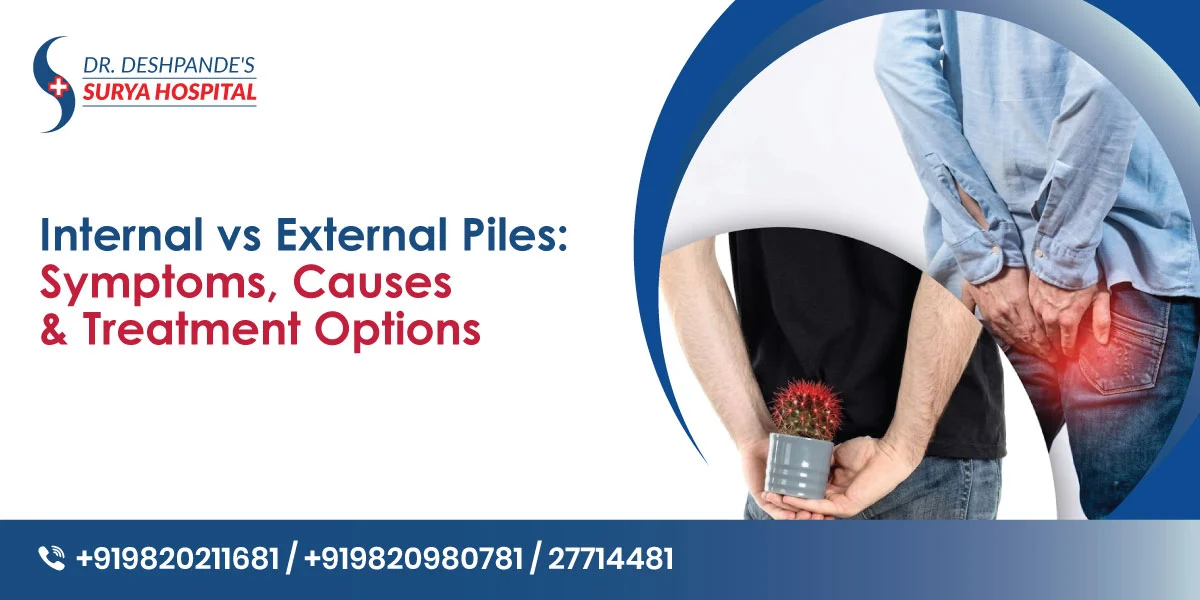 Internal vs External Piles: Common Symptoms and Causes